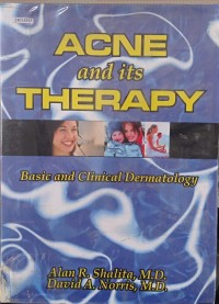 Image of Acne and its therapy