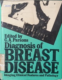 Image of Diagnosis of breast disease