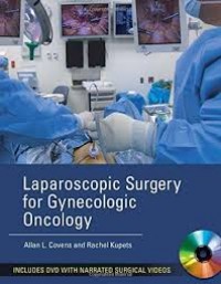 Image of Laparoscopic surgery for gynecologic oncology